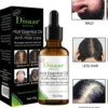 Tratamiento Anticaída del Cabello Disaar – Aceite Esencial 30 g